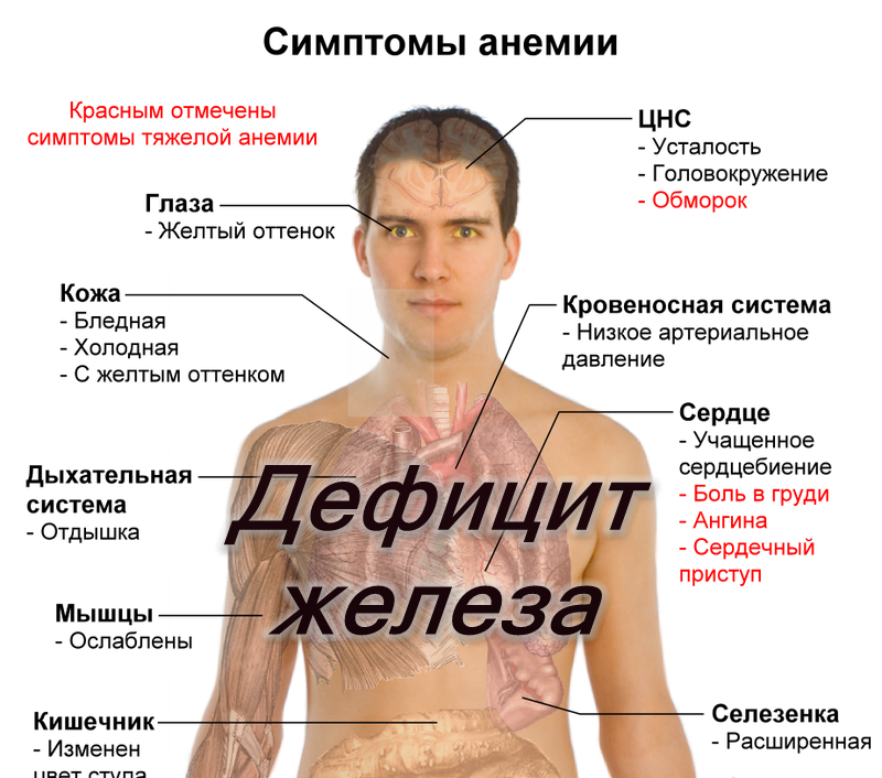 Нехватка железа в организме симптомы