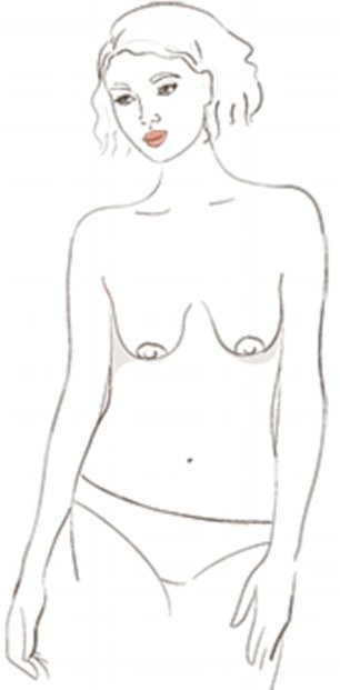 Relaxed breasts feature downward pointing nipples and lax tissue
