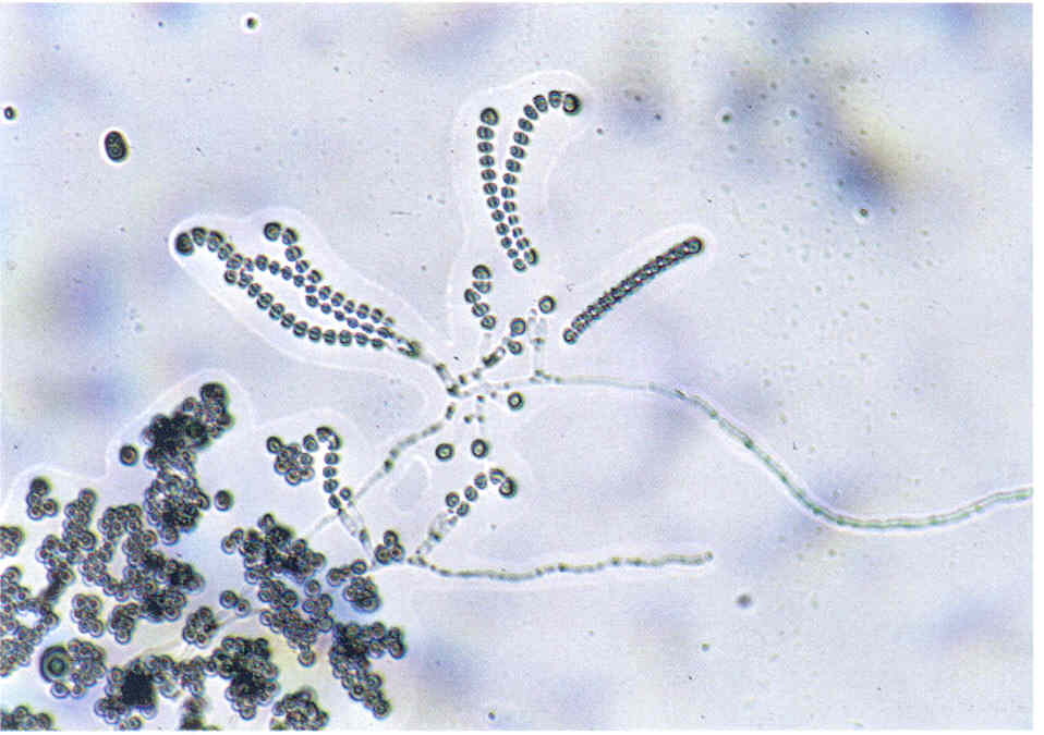 Споры candida. Грибы кандида микроскопия. Мицелий гриба микроскопия. Кандида плесневые грибы. Кандида альбиканс микроскопия.