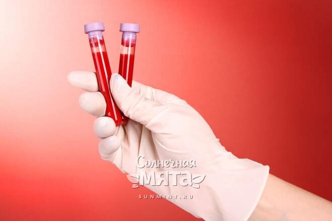 Две ампулы с анализами крови в руке медсестры, фото