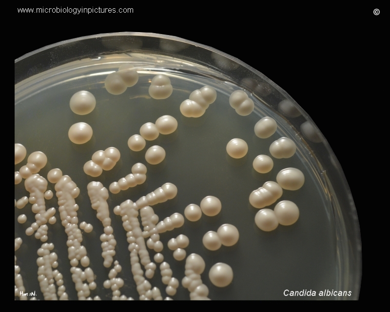 Молочница гриб. Грибы альбиканс кандида микробиология.