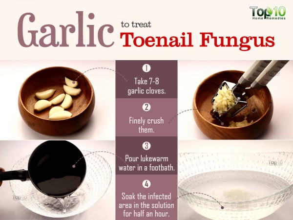 garlic for toenail fungus